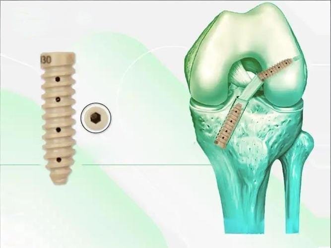 A high-precision dental implant screw and a detailed illustration of a knee joint with measuring too.